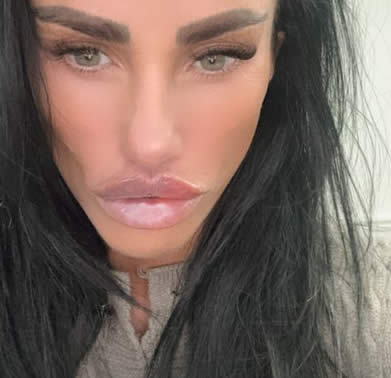 Katie Price Biggest Lips Ever