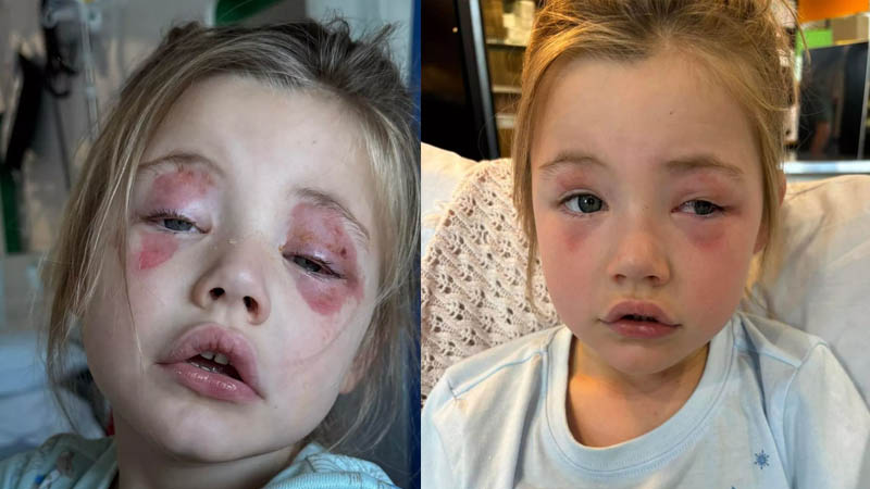 Girl Blinded After Biting Persil Pod as Furious Mom Slams ‘Inadequate’ Warnings